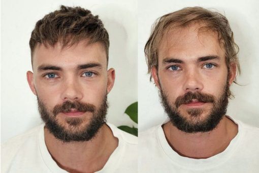 Mens hair system